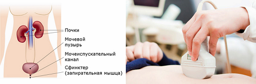 УЗИ органов мочевыделительной системы (почки, мочеточники, мочевой пузырь)