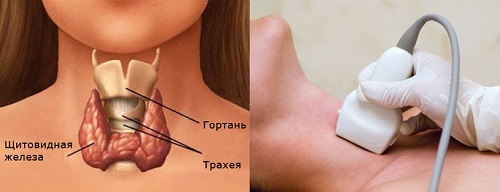 УЗИ щитовидной железы