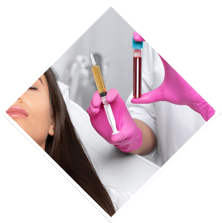 PRP-ТЕРАПИЯ CORTEXIL