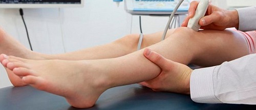 УЗИ сосудов верхних и нижних конечностей