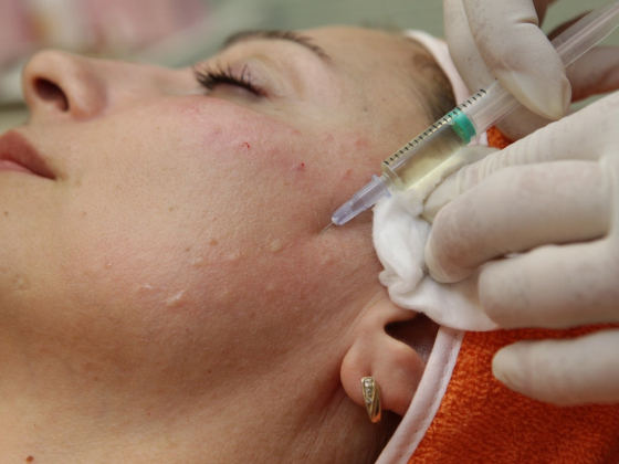 Процедуры инъекционной косметологии